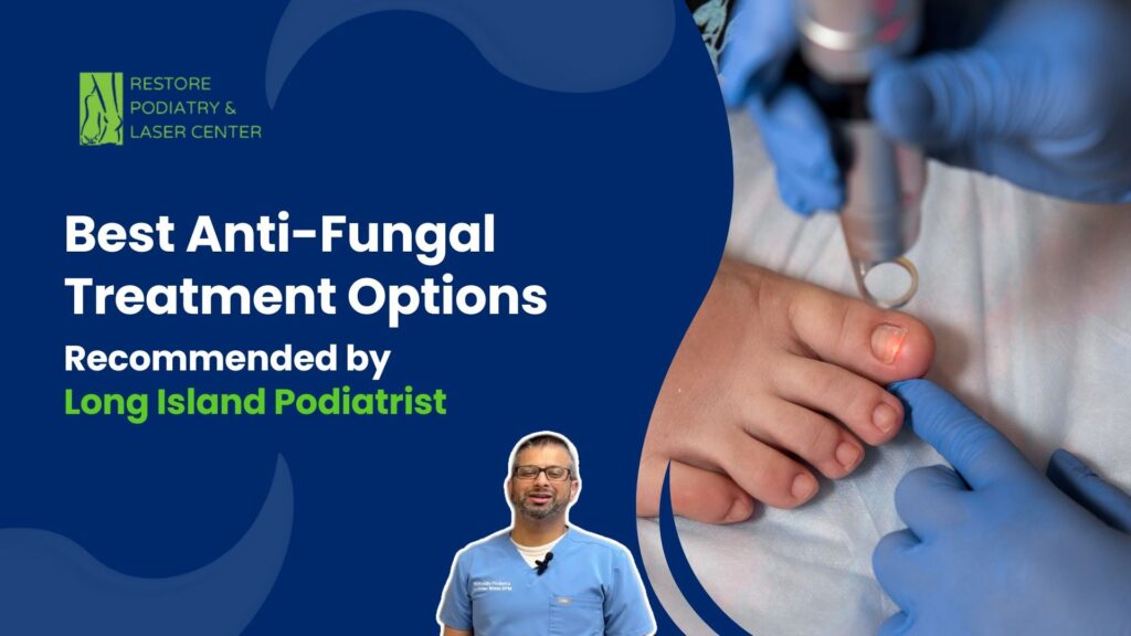 The Best Anti-Fungal Treatment Options Recommended by Long Island Podiatrist