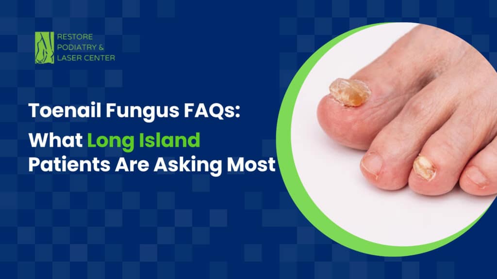 Toenail Fungus FAQs What Long Island Patients Are Asking Most