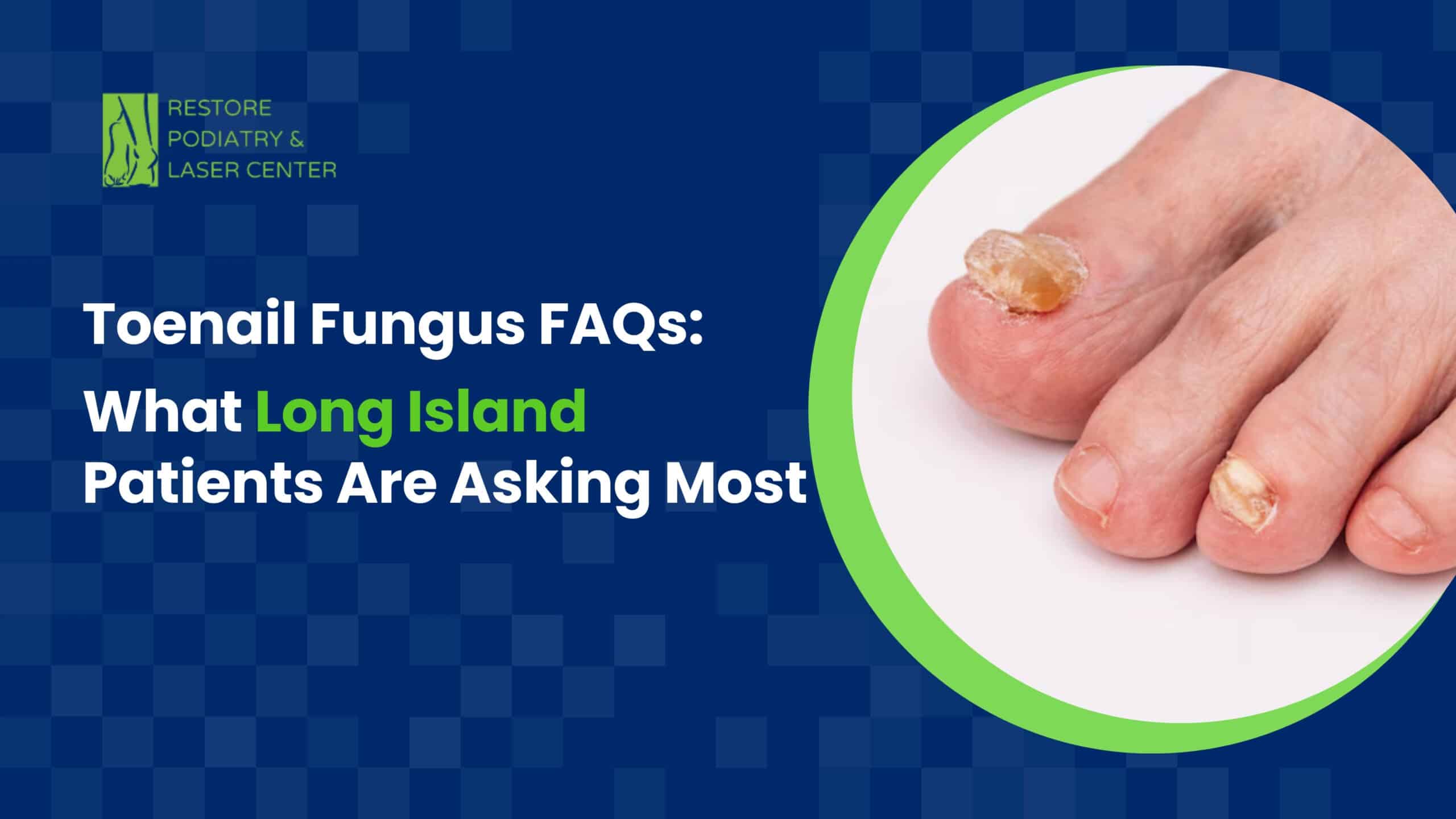 Toenail Fungus FAQs What Long Island Patients Are Asking Most