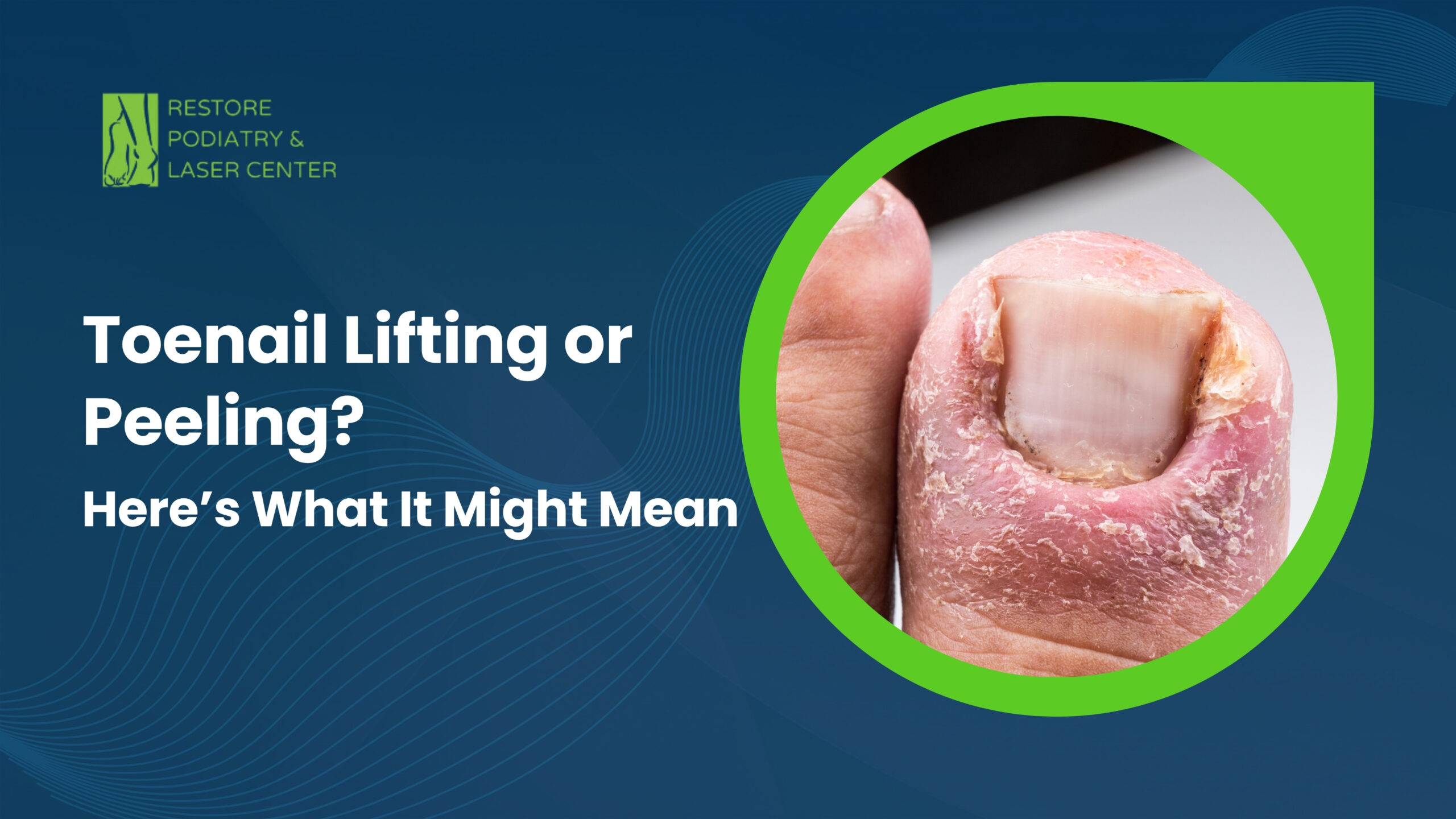 Toenail Lifting or Peeling Here’s What It Might Mean