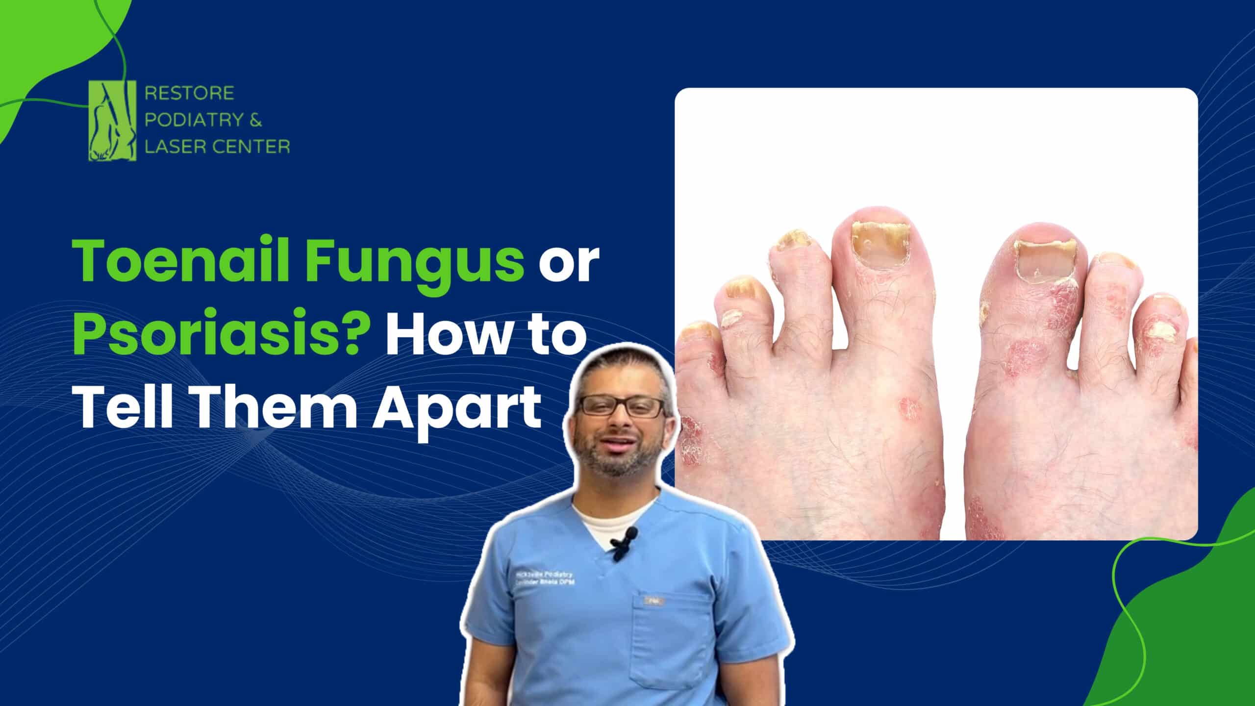 Toenail Fungus or Psoriasis How to Tell Them Apart