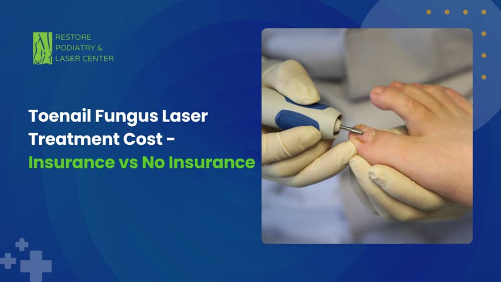 Toenail Fungus Laser Treatment Cost - Insurance vs No Insurance