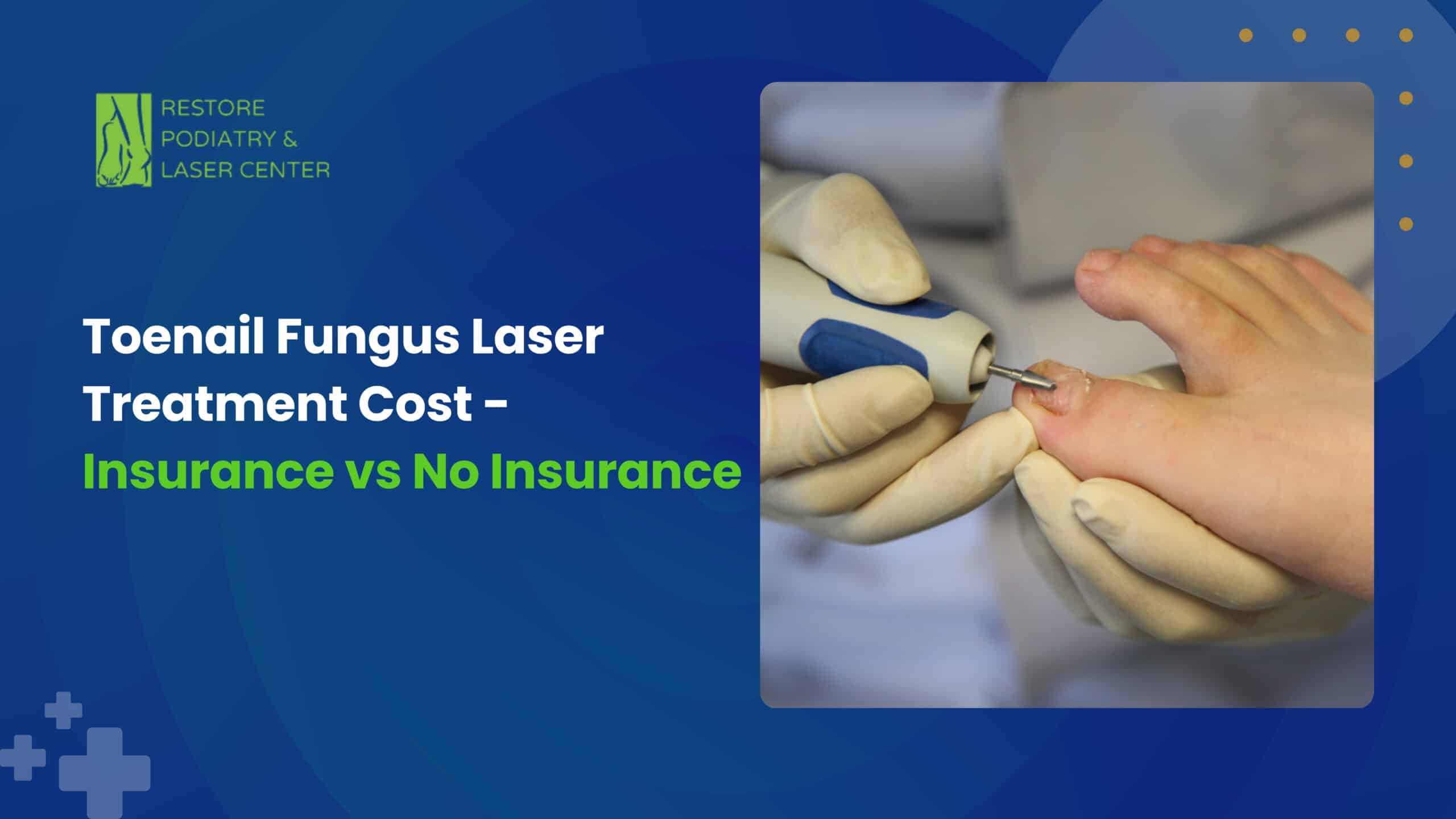 Toenail Fungus Laser Treatment Cost - Insurance vs No Insurance
