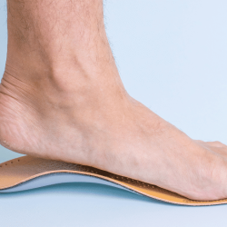 Adult Acquired Flatfoot Treatment Options