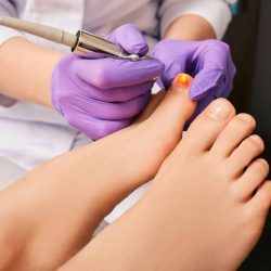 Best Treatment for Toenail Fungus – Laser Therapy at Restore Podiatry