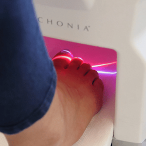 Lunula Laser Therapy