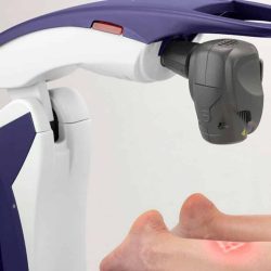 Nd YAG Laser Therapy (2)