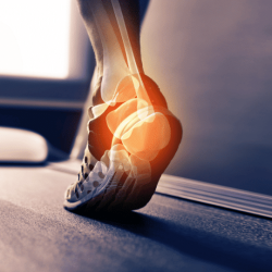 Treatment Options for Heel Pain at Restore
