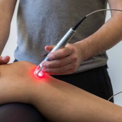 laser knee dreamstime_l_112760554 (1)